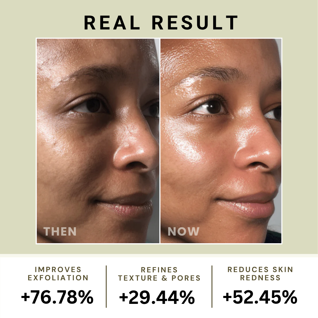 Relief Mud Mask & Cleanser Duo