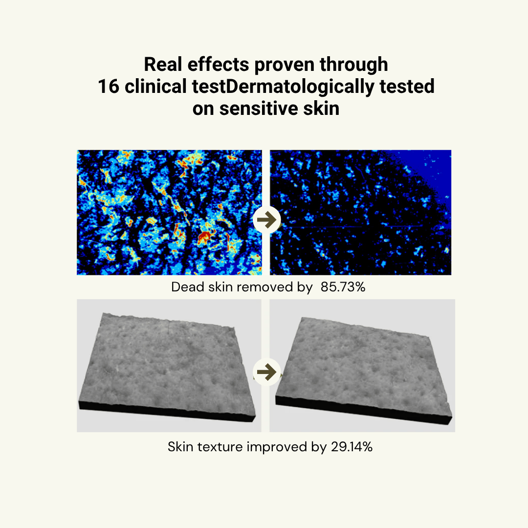 Relief Mud Peel Off Mask - BRMUD US OfficialSkincareBRMUD US Official