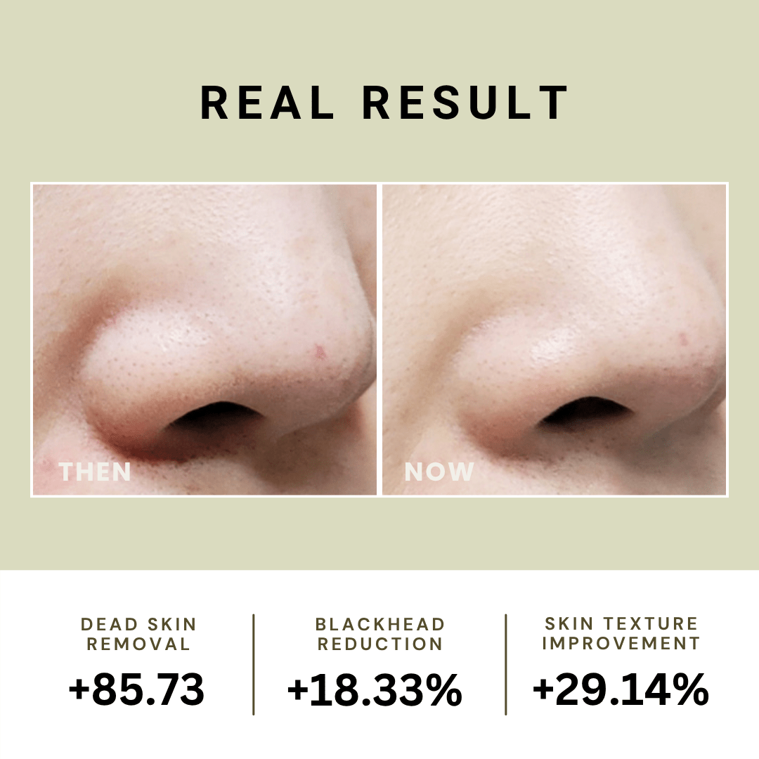 Relief Mud Peel Off Mask - BRMUD US OfficialSkincareBRMUD US Official