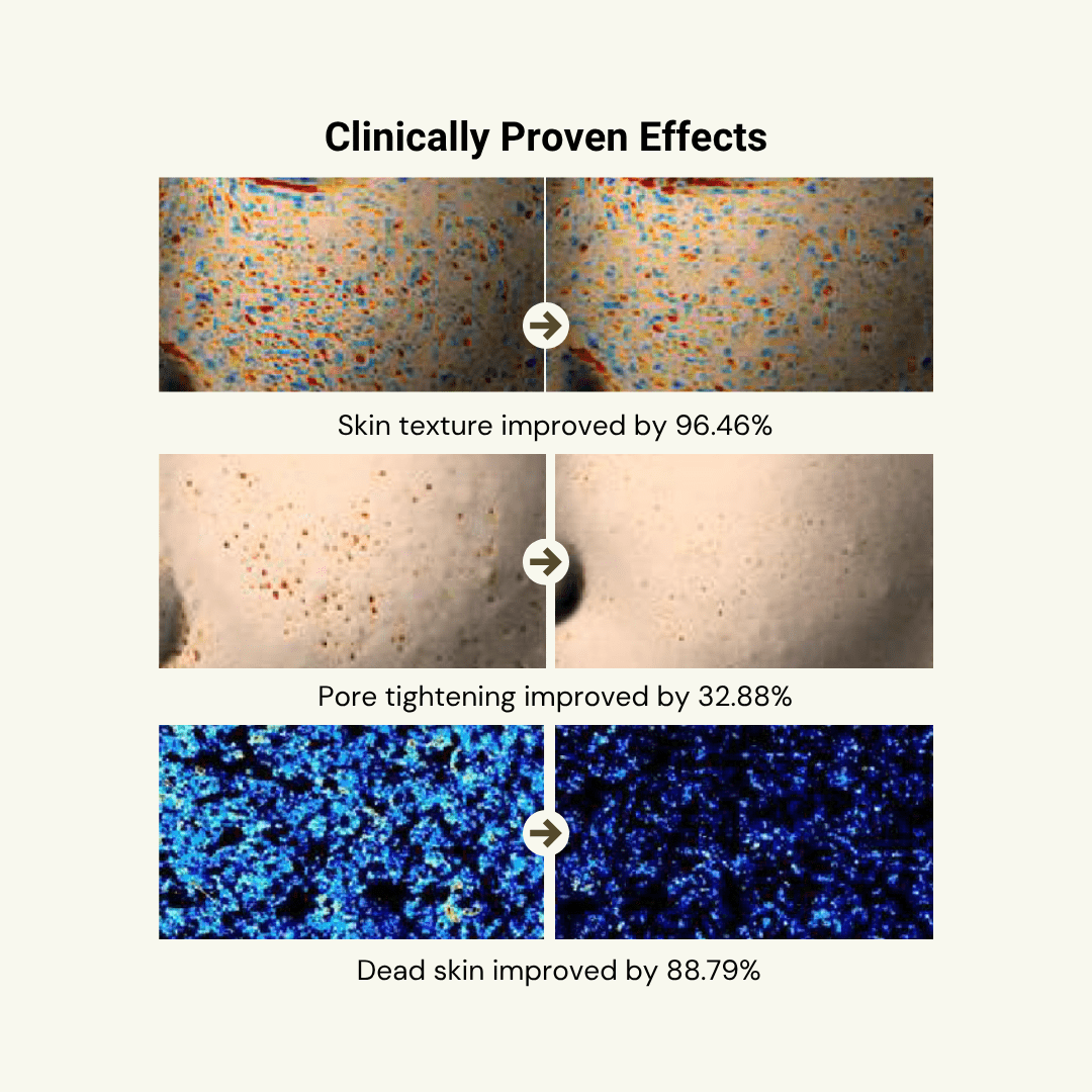 Relief Mud Stick Mask - BRMUD US OfficialSkincareBRMUD US Official