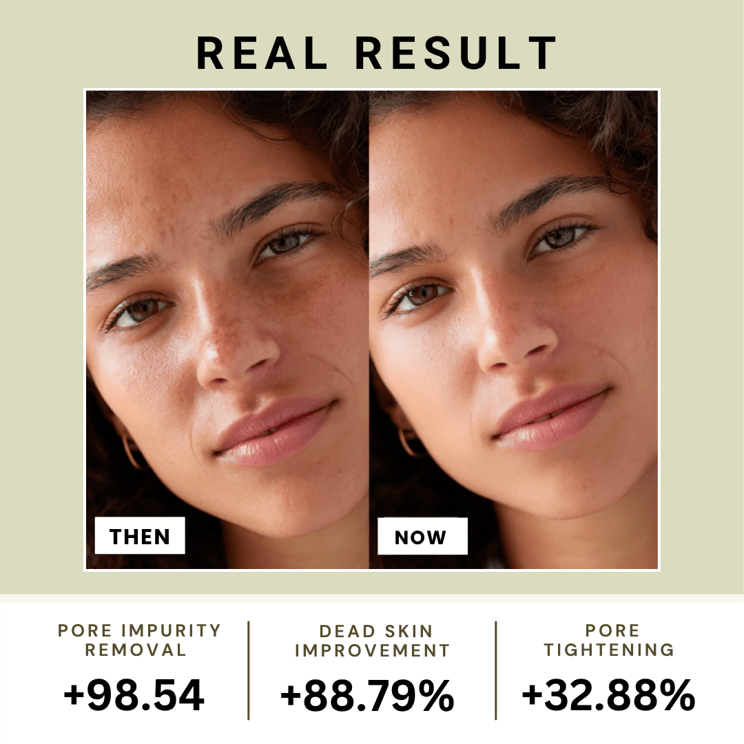 Relief Mud Stick Mask - BRMUD US OfficialSkincareBRMUD US Official